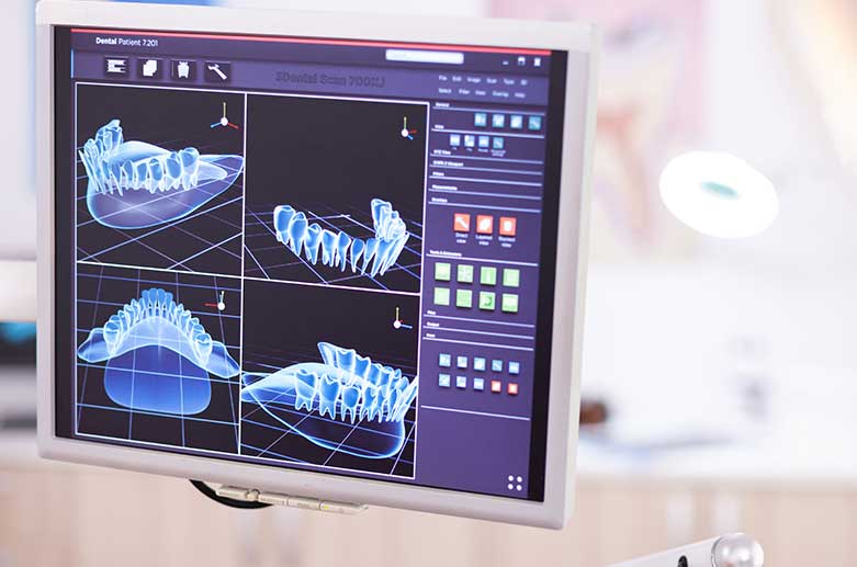 implantate-dentise-dahm-03